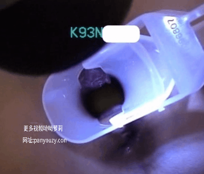 图片[1]-【特殊资源】插入内窥镜并往里尿尿[ 5V]-uu欢迎您！